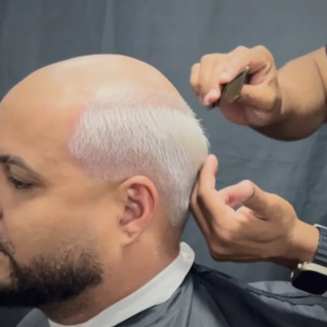 Linha da frente do cabelo sendo acertada à mão em um atendimento de prótese capilar